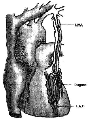 1109_Arterial conduits.png